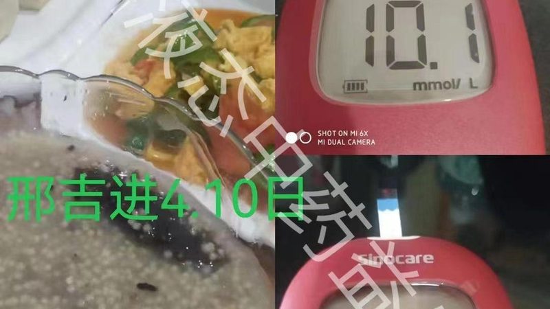 胶原蛋白的补充并非适用于所有年龄段。一般来说，以下人群需要特别注意补充胶原蛋白：